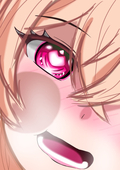 MS